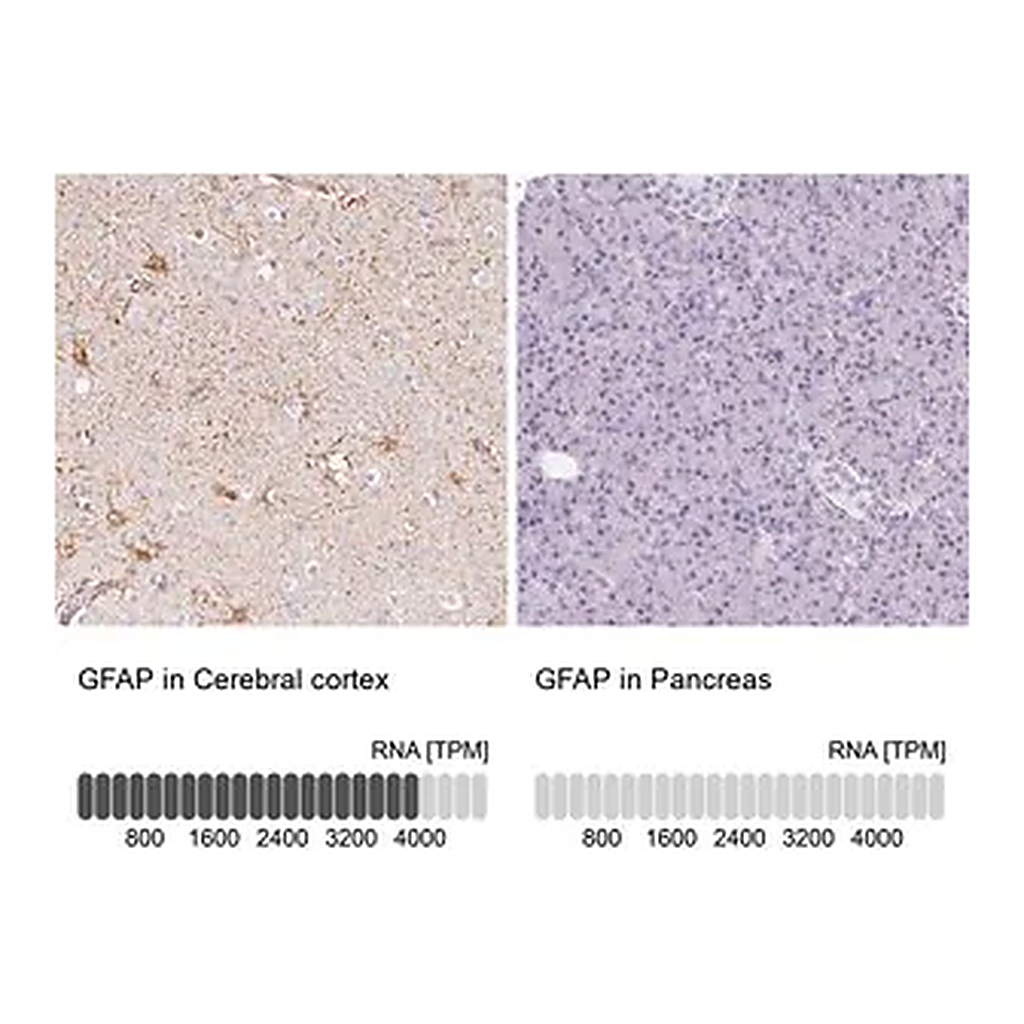Merck Anti-GFAP antibody produced in rabbit