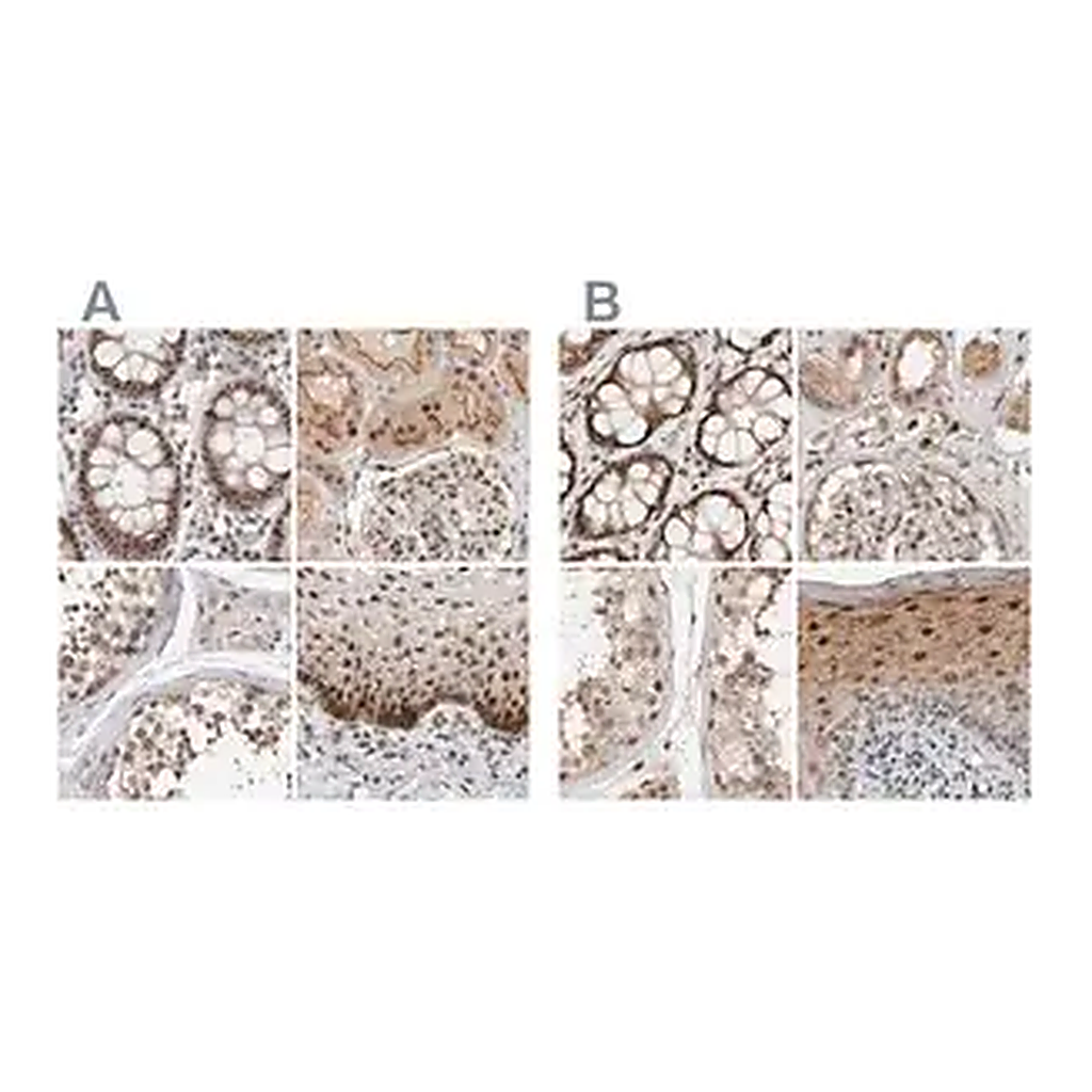 Merck Anti-ZNF521 antibody produced in rabbit