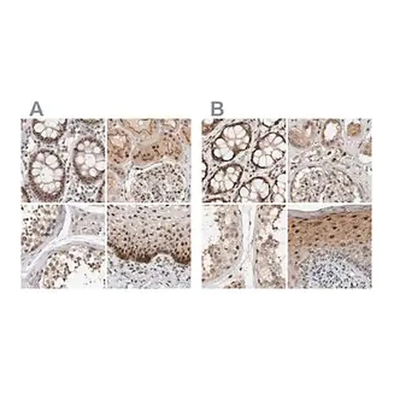 Merck Anti-ZNF521 antibody produced in rabbit