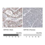 Merck Anti-CEP192 antibody produced in rabbit
