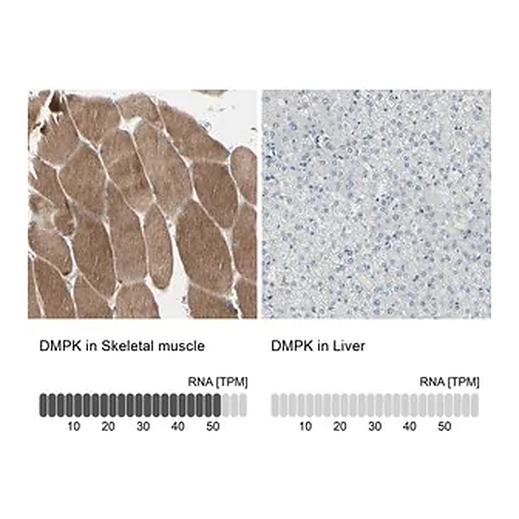 Merck Anti-DMPK antibody produced in rabbit