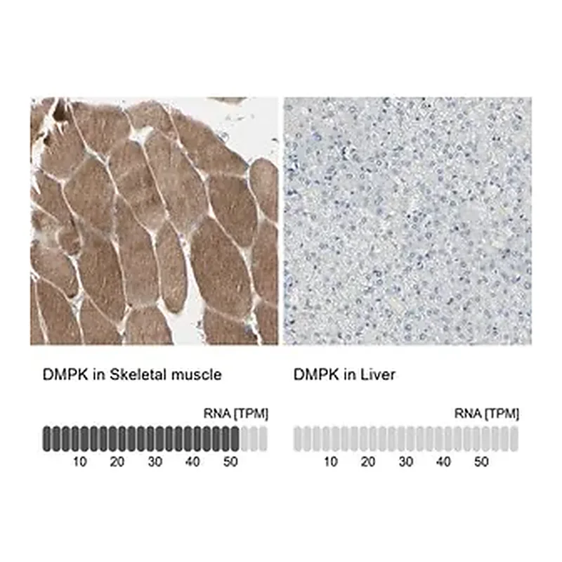 Merck Anti-DMPK antibody produced in rabbit