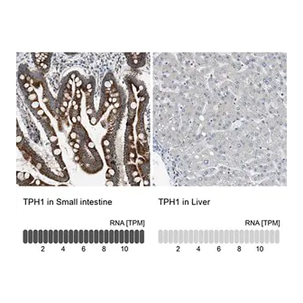 Merck Anti-TPH1 antibody produced in rabbit