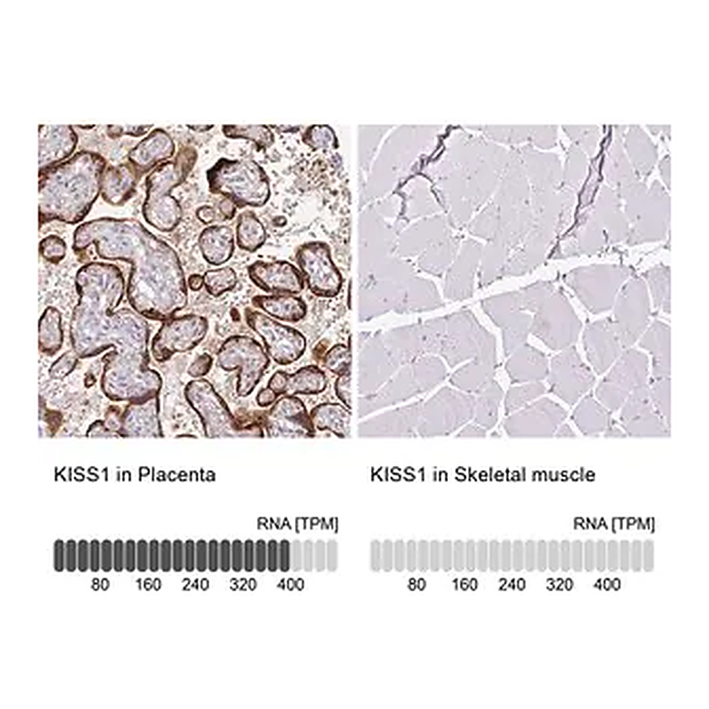 Merck Anti-KISS1 antibody produced in rabbit