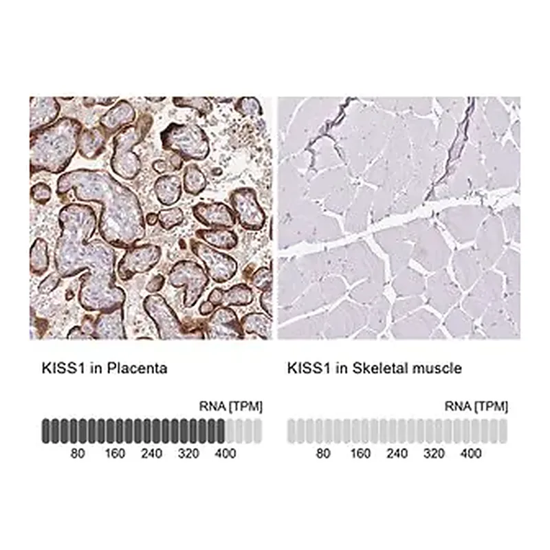 Merck Anti-KISS1 antibody produced in rabbit