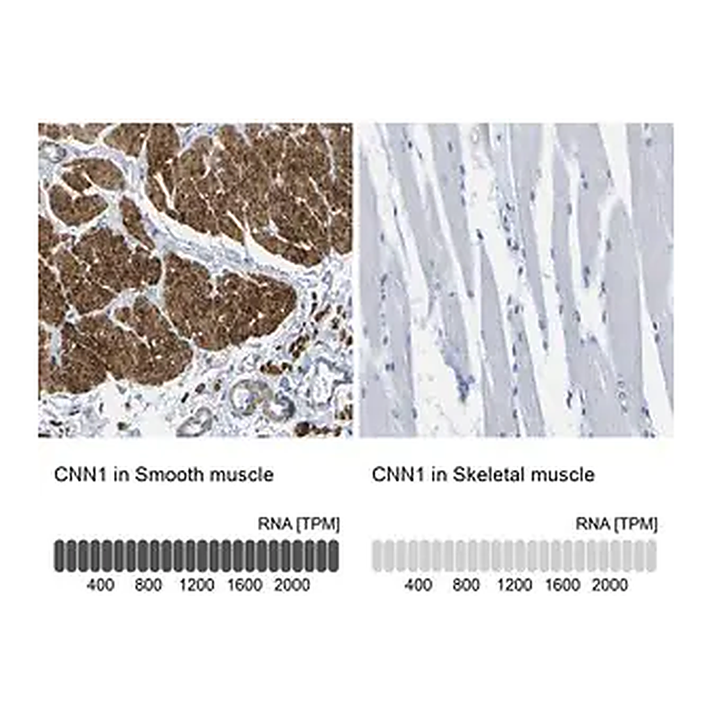 Merck Anti-CNN1 antibody produced in rabbit