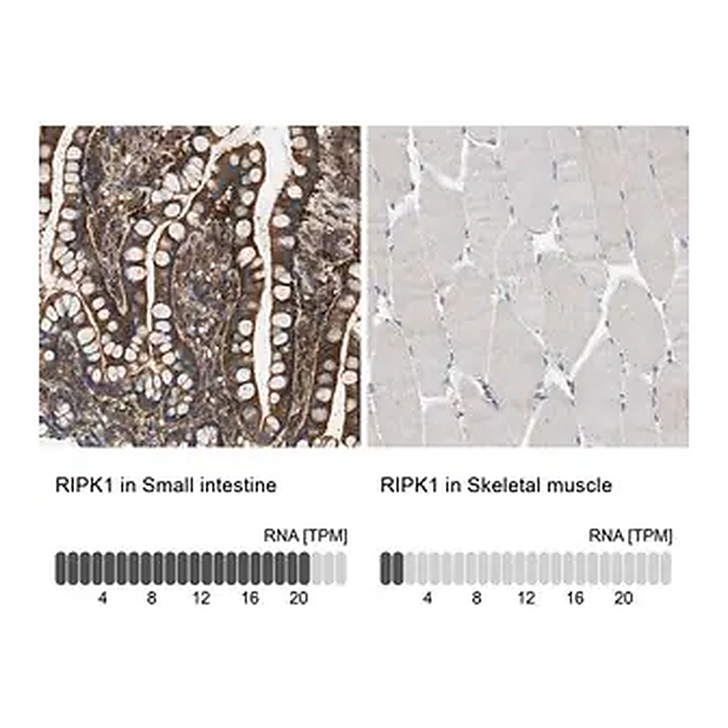 Merck Anti-RIPK1 antibody produced in rabbit