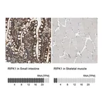 Merck Anti-RIPK1 antibody produced in rabbit