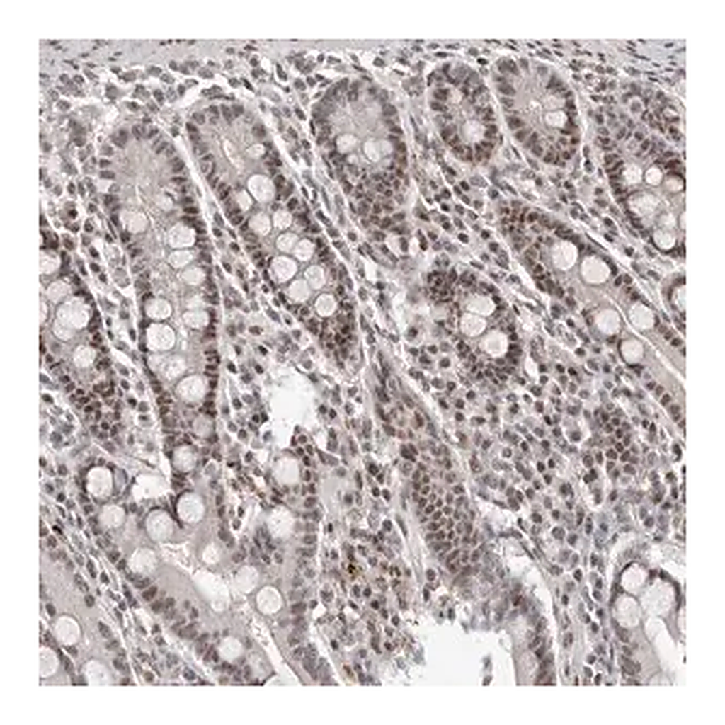 Merck Anti-ATF5 antibody produced in rabbit