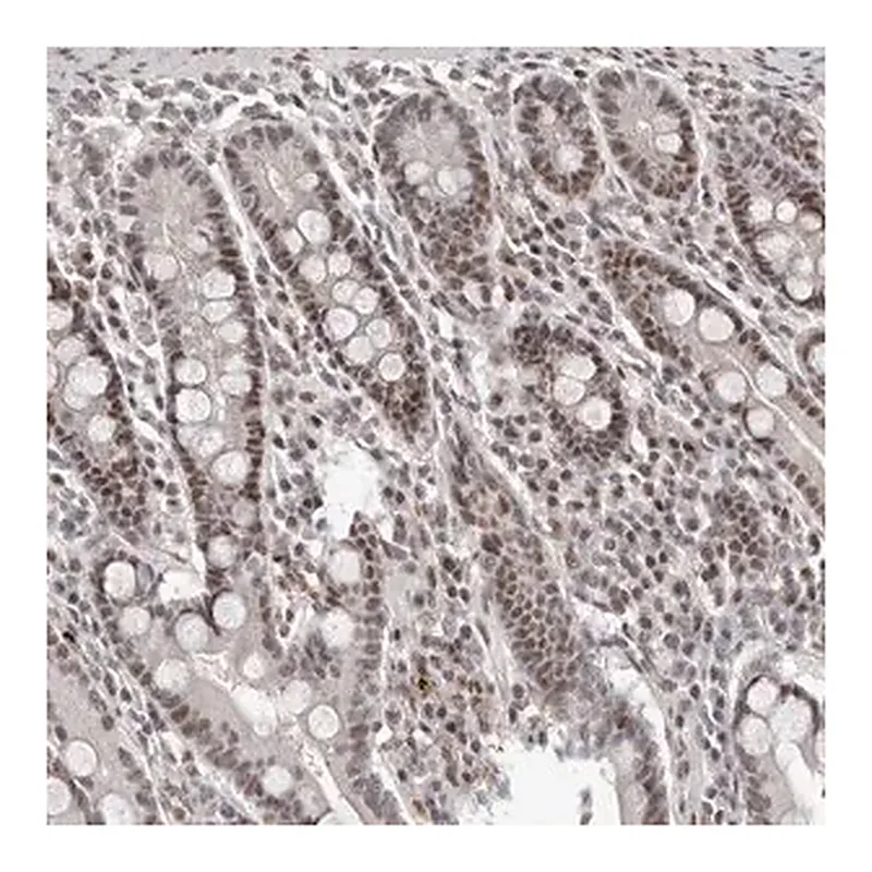 Merck Anti-ATF5 antibody produced in rabbit