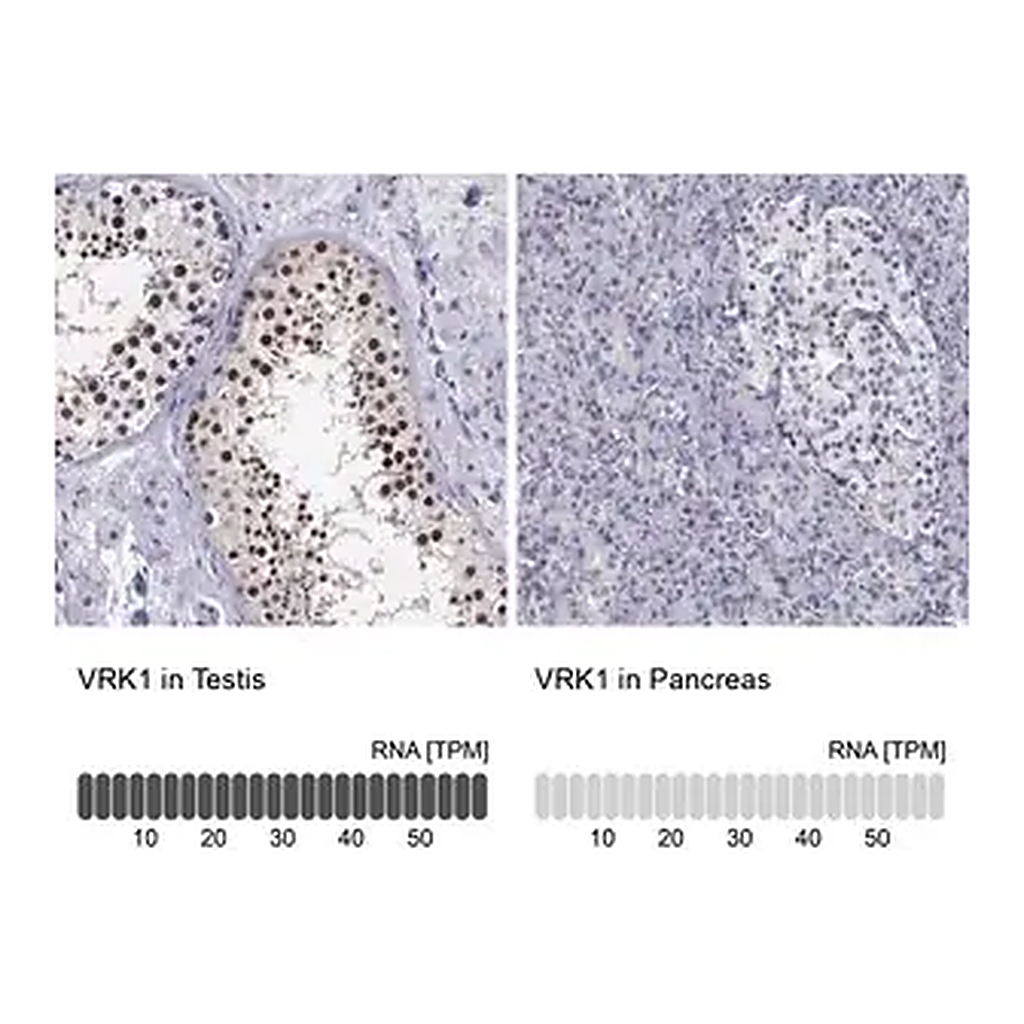 Merck Anti-VRK1 antibody produced in rabbit