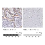 Merck Anti-SLC5A1 antibody produced in rabbit