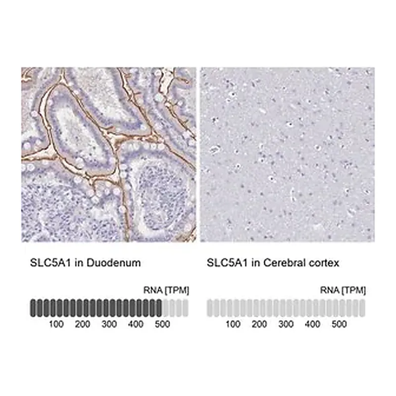 Merck Anti-SLC5A1 antibody produced in rabbit