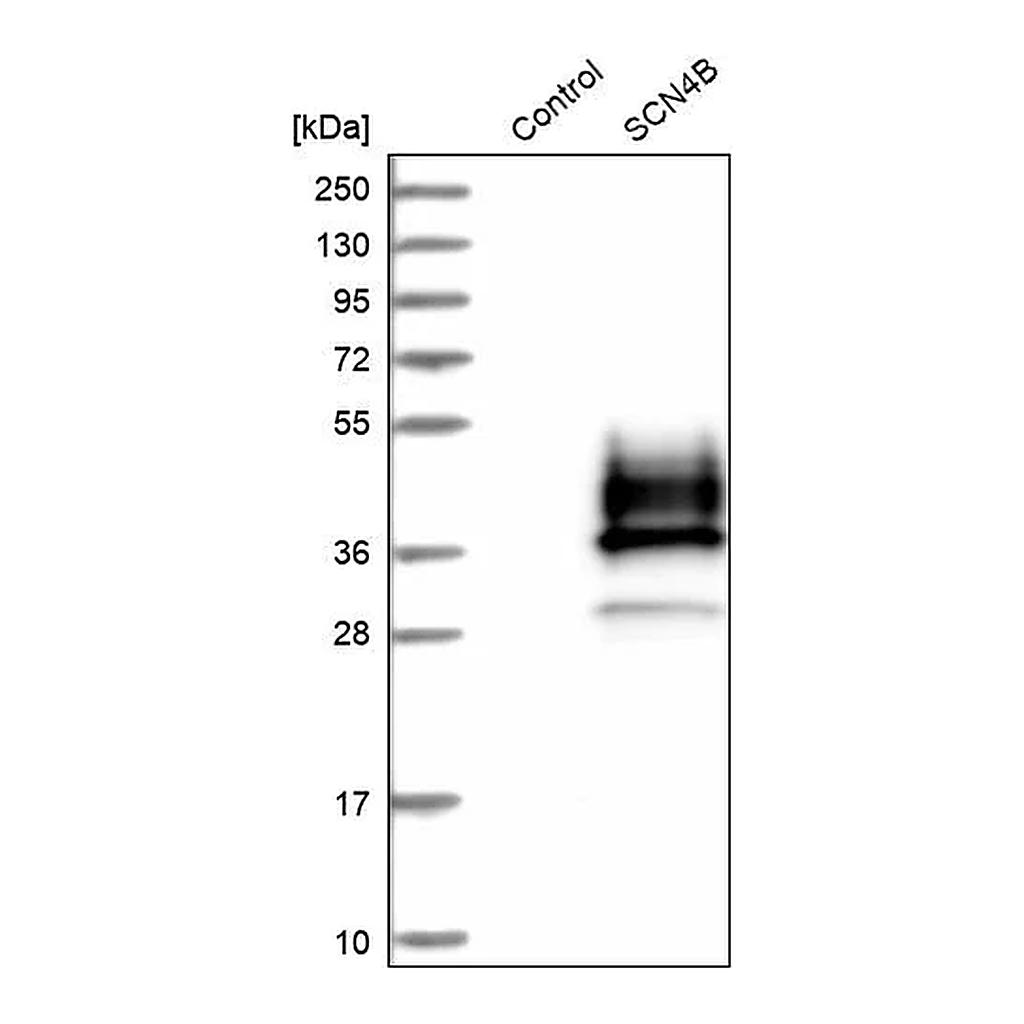 Merck Anti-SCN4B antibody produced in rabbit