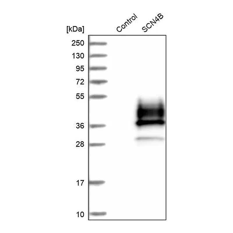 Merck Anti-SCN4B antibody produced in rabbit