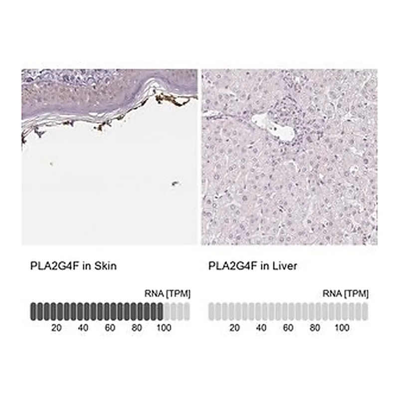 Merck Anti-PLA2G4F antibody produced in rabbit