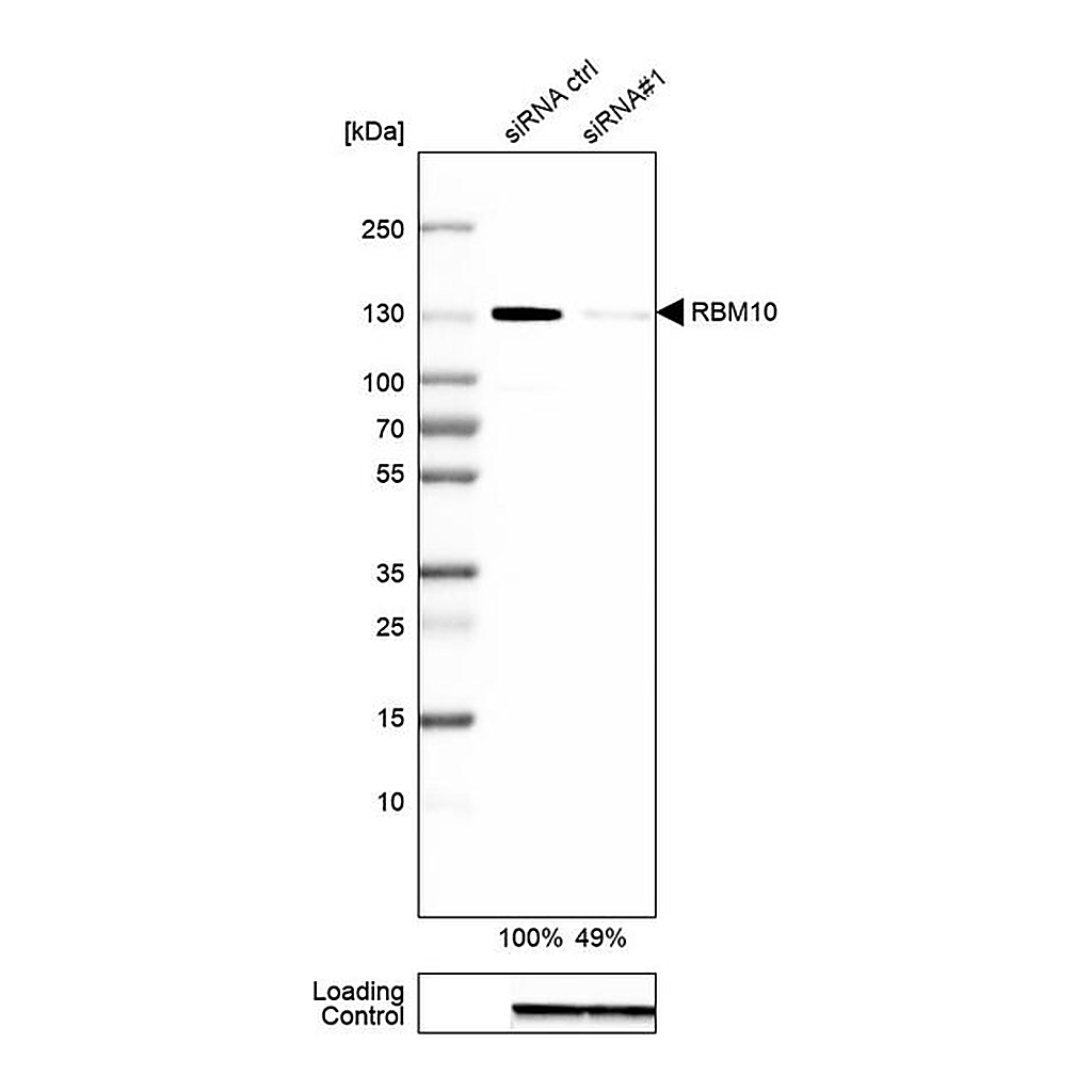 Merck Anti-RBM10 antibody produced in rabbit