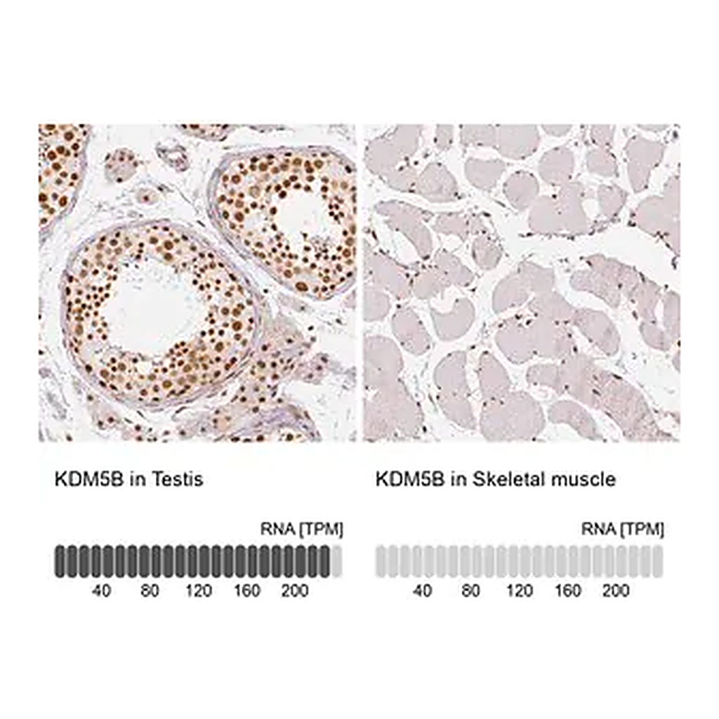 Merck Anti-KDM5B antibody produced in rabbit