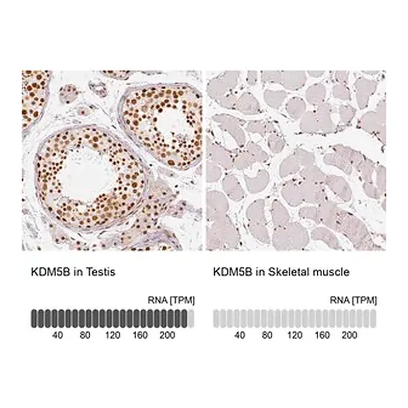 Merck Anti-KDM5B antibody produced in rabbit