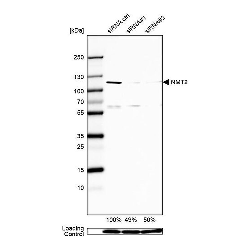 Merck Anti-NMT2 antibody produced in rabbit