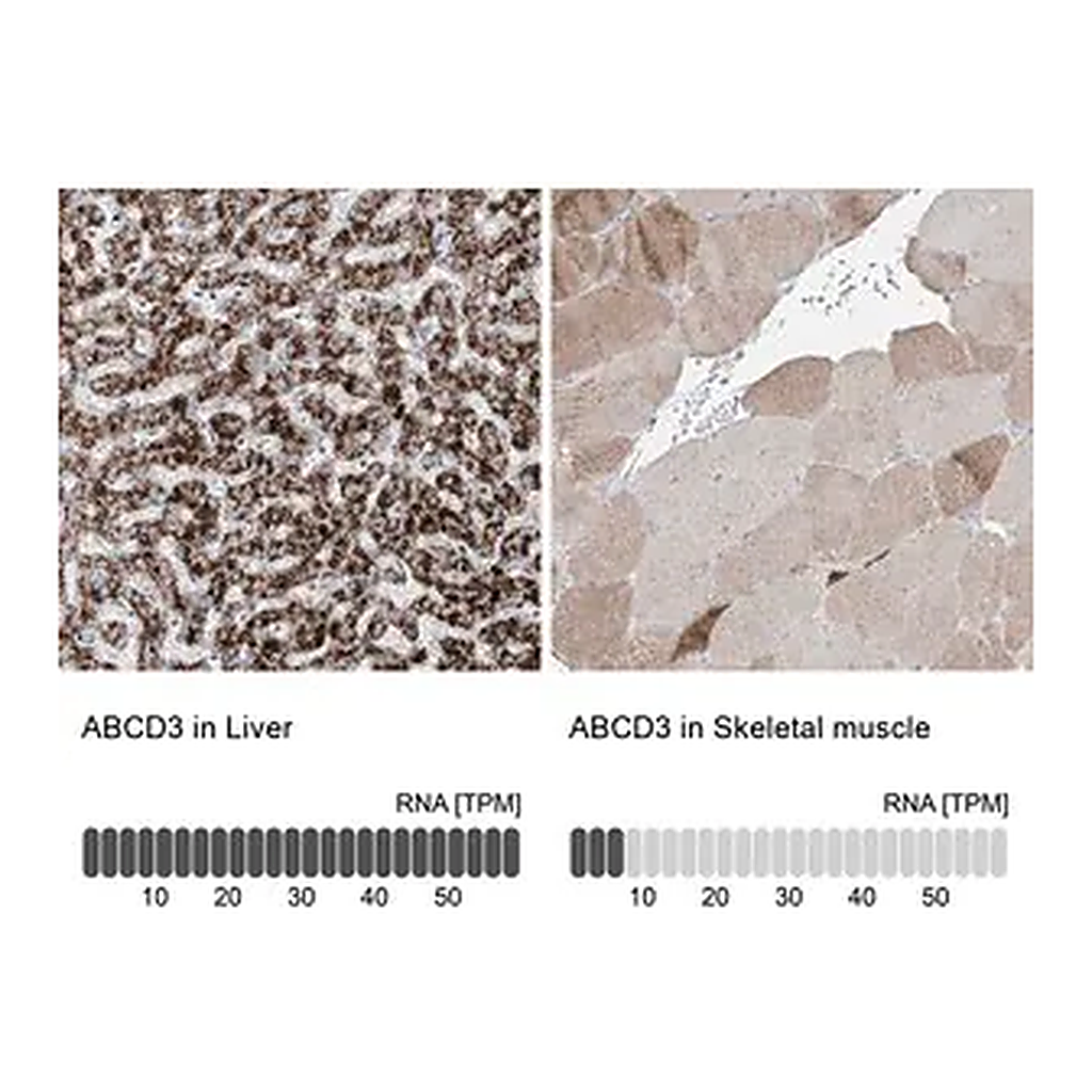 Merck Anti-ABCD3 antibody produced in rabbit