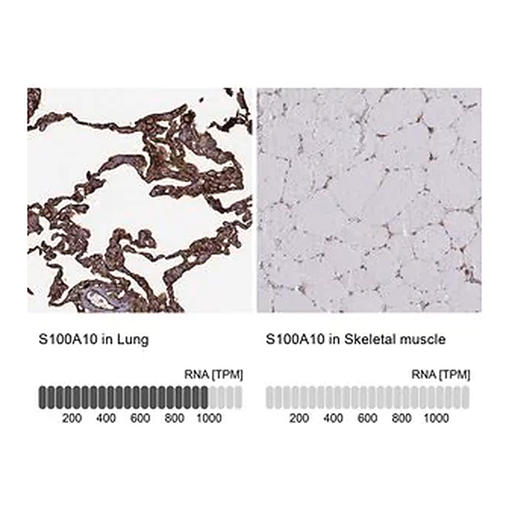Merck Anti-S100A10 antibody produced in rabbit