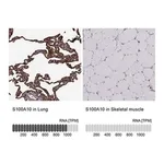 Merck Anti-S100A10 antibody produced in rabbit