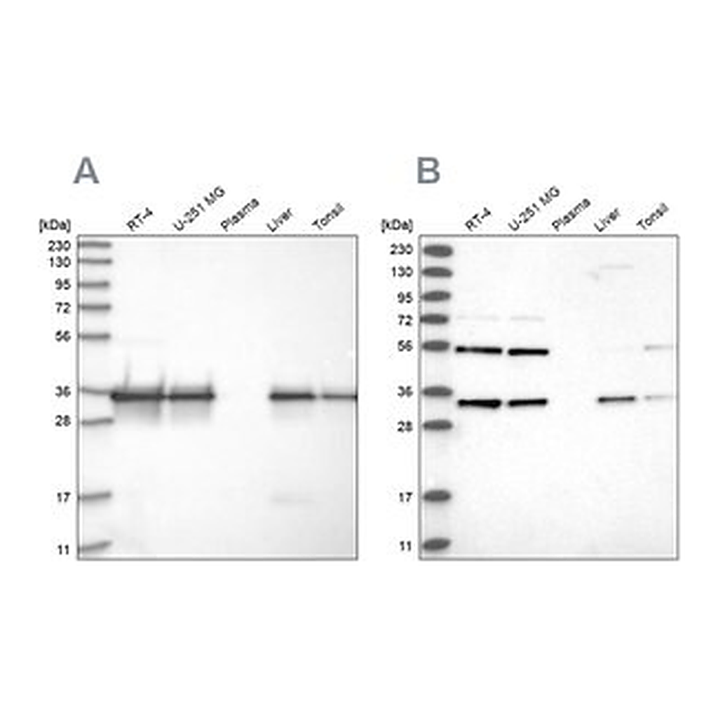 Merck Anti-PPA2 antibody produced in rabbit