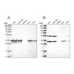 Merck Anti-PPA2 antibody produced in rabbit