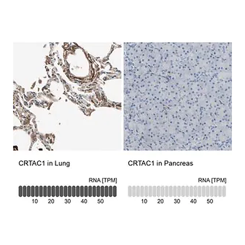 Merck Anti-CRTAC1 antibody produced in rabbit