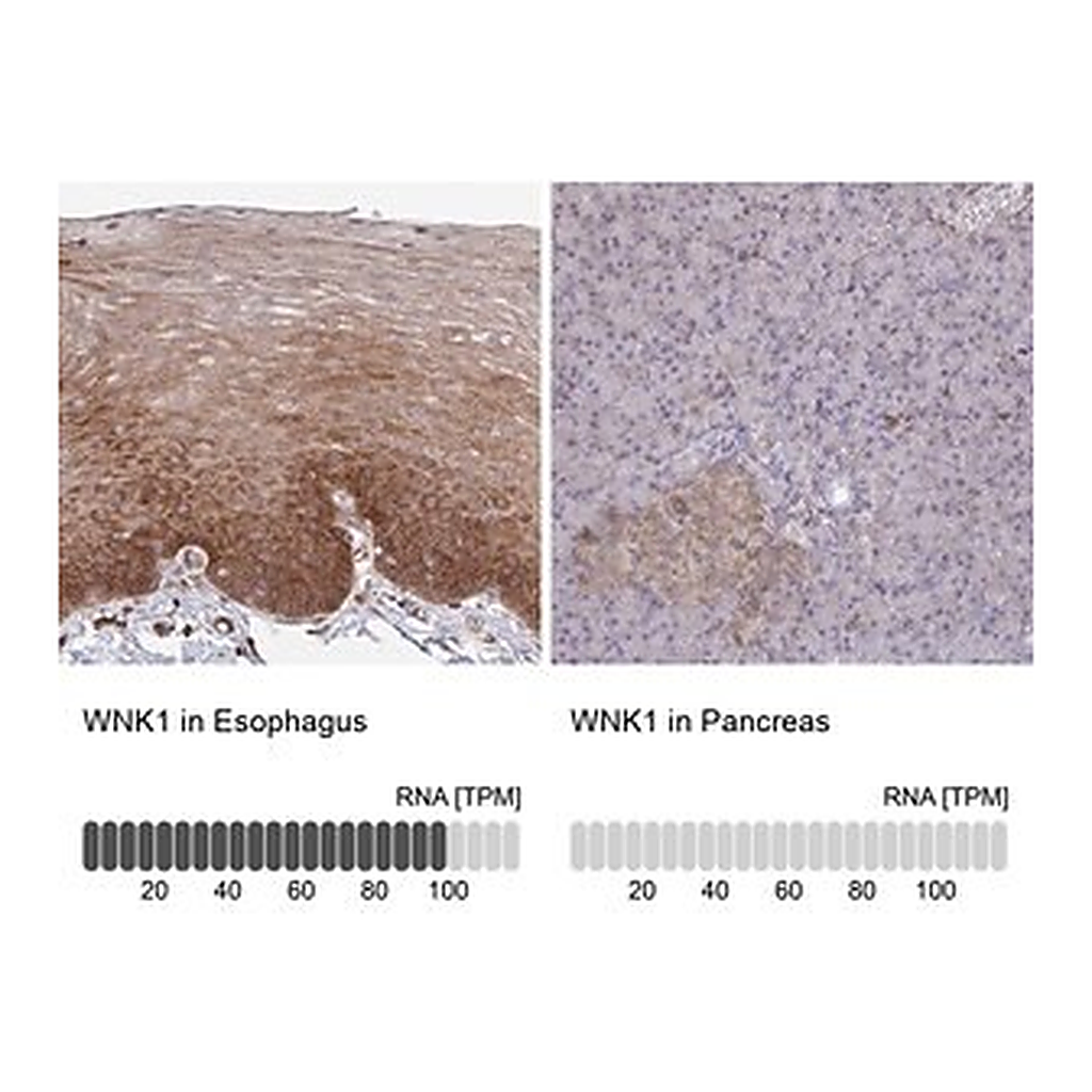 Merck Anti-WNK1 antibody produced in rabbit