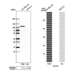Merck Anti-SLFN5 antibody produced in rabbit