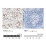 Merck Anti-KCNJ1 antibody produced in rabbit