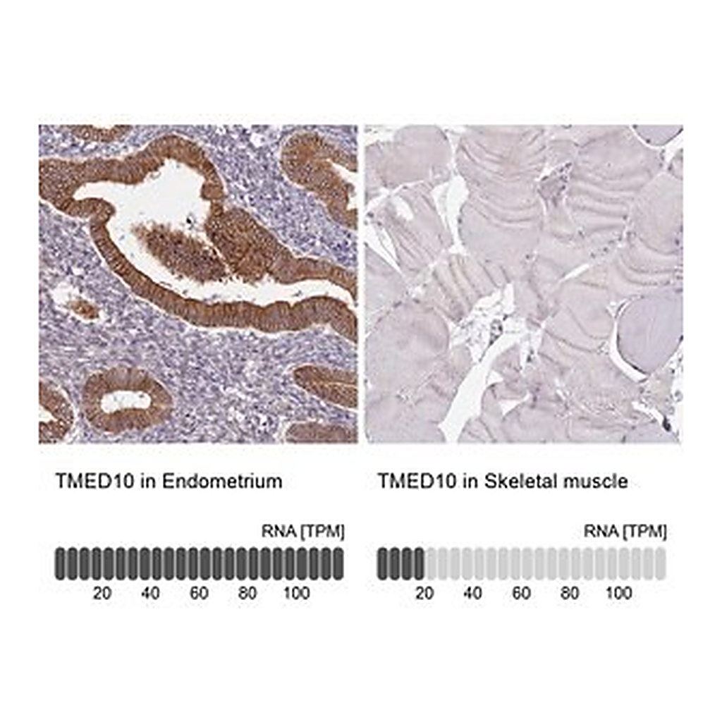 Merck Anti-TMED10 antibody produced in rabbit