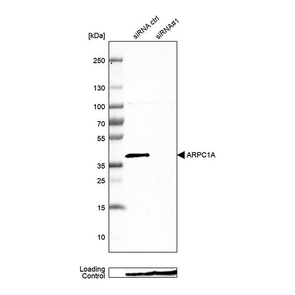 Merck Anti-ARPC1A antibody produced in rabbit