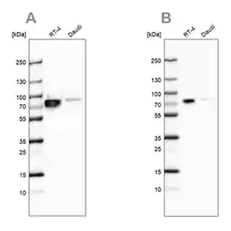 Merck Anti-DDX3X antibody produced in rabbit