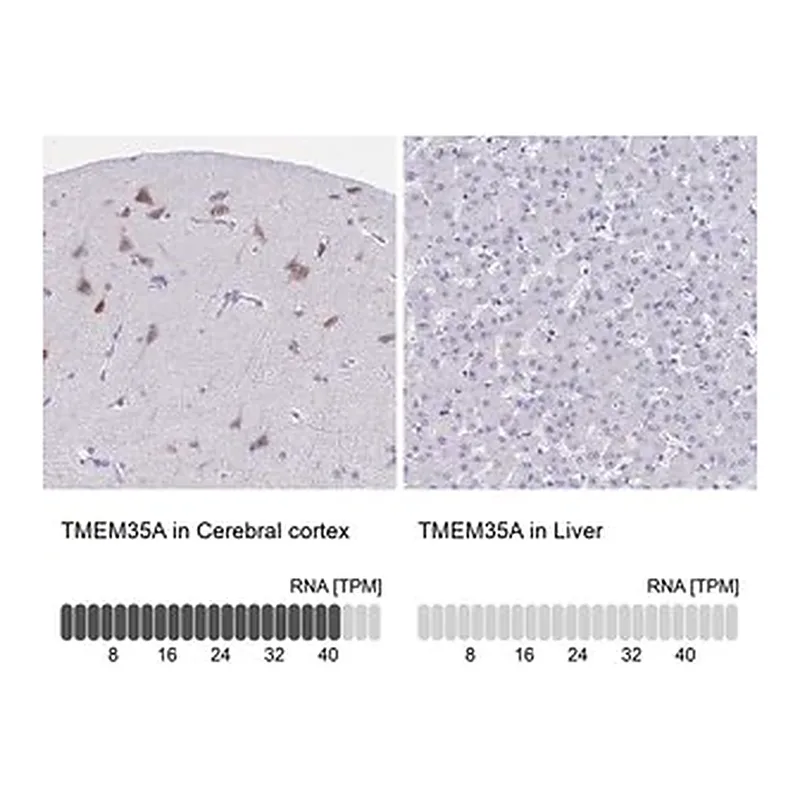 Merck Anti-TMEM35A antibody produced in rabbit