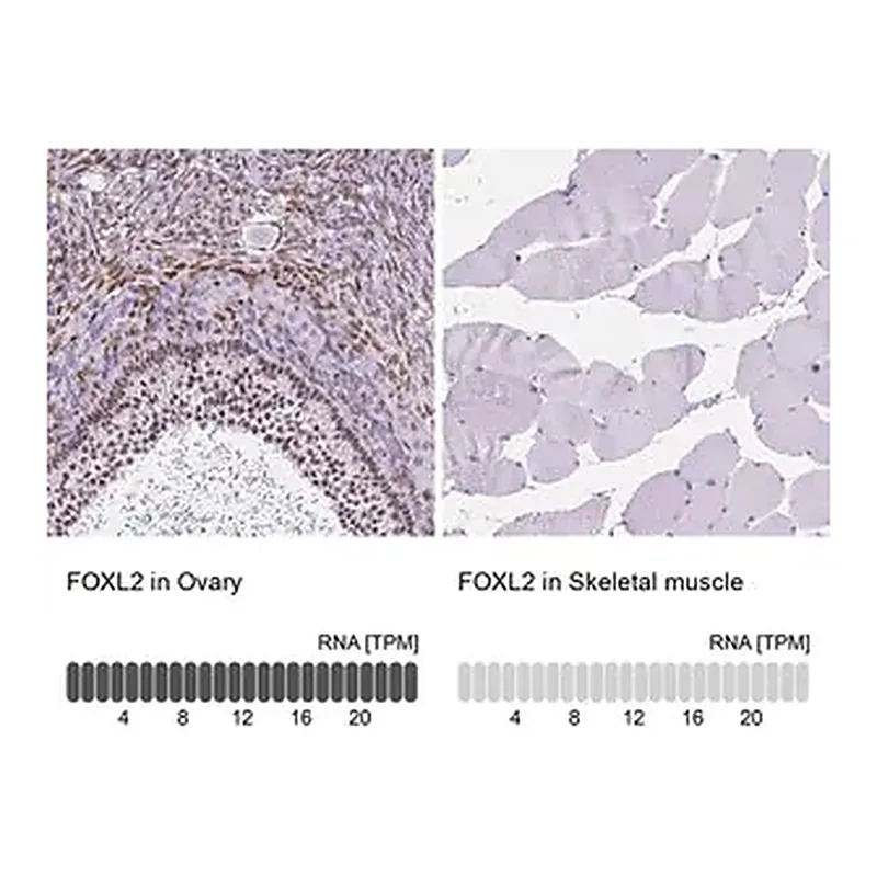 Merck Anti-FOXL2 antibody produced in rabbit