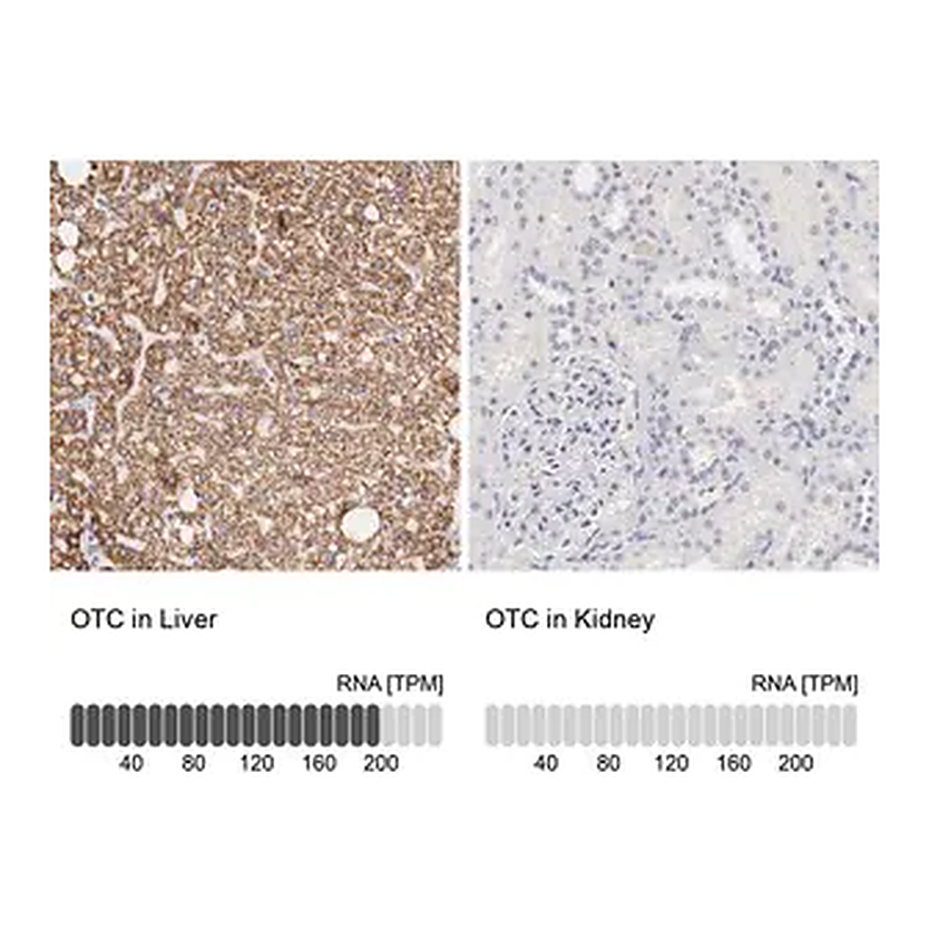 Merck Anti-OTC antibody produced in rabbit