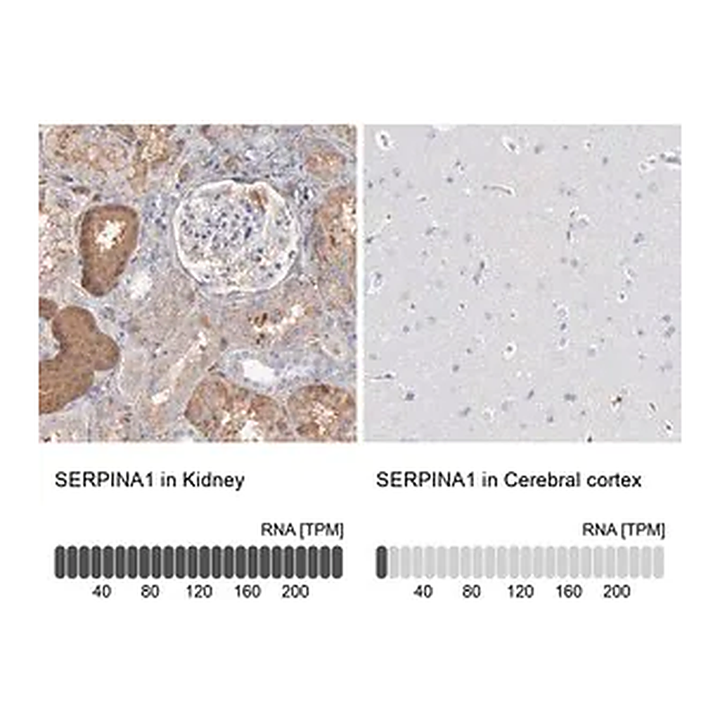 Merck Anti-SERPINA1 antibody produced in rabbit