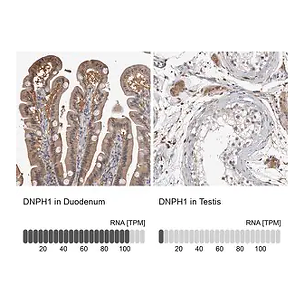 Merck Anti-DNPH1 antibody produced in rabbit