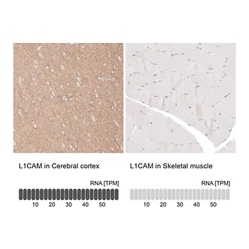 Merck Anti-L1CAM antibody produced in rabbit