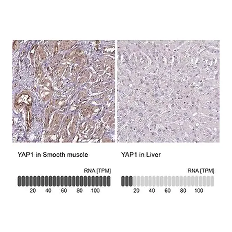 Merck Anti-YAP1