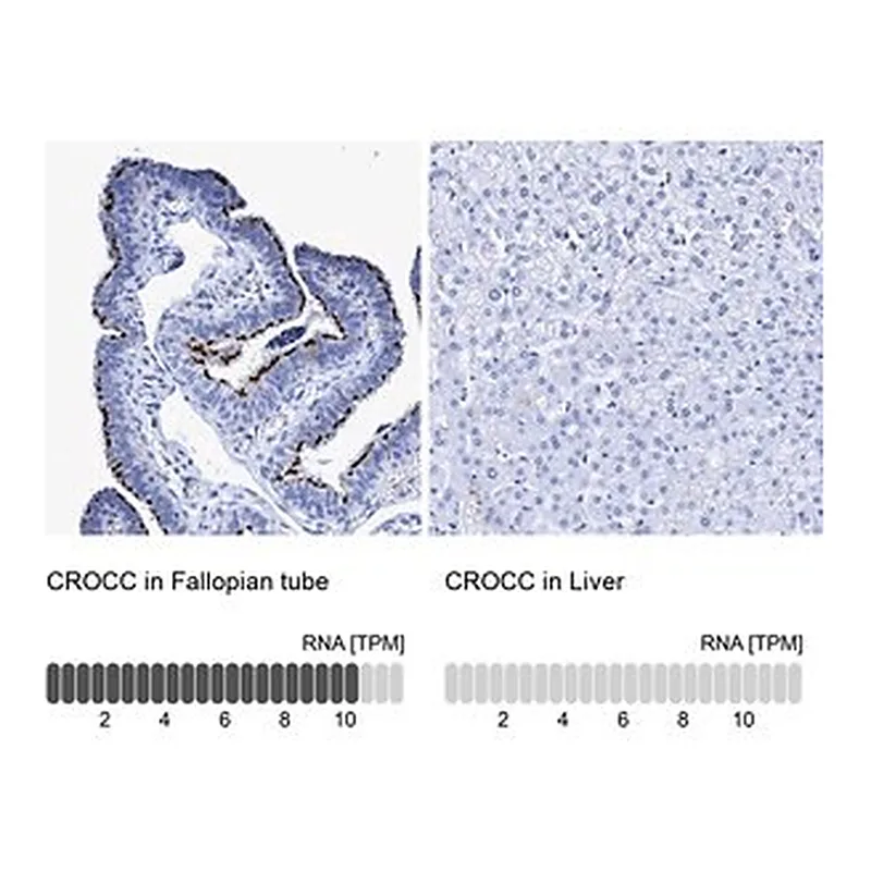 Merck Anti-CROCC antibody produced in rabbit