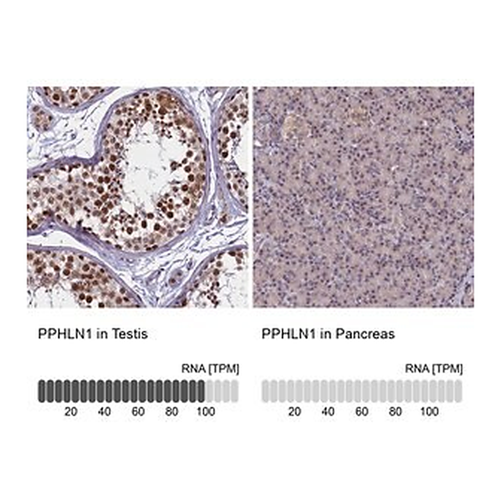Merck Anti-PPHLN1 antibody produced in rabbit
