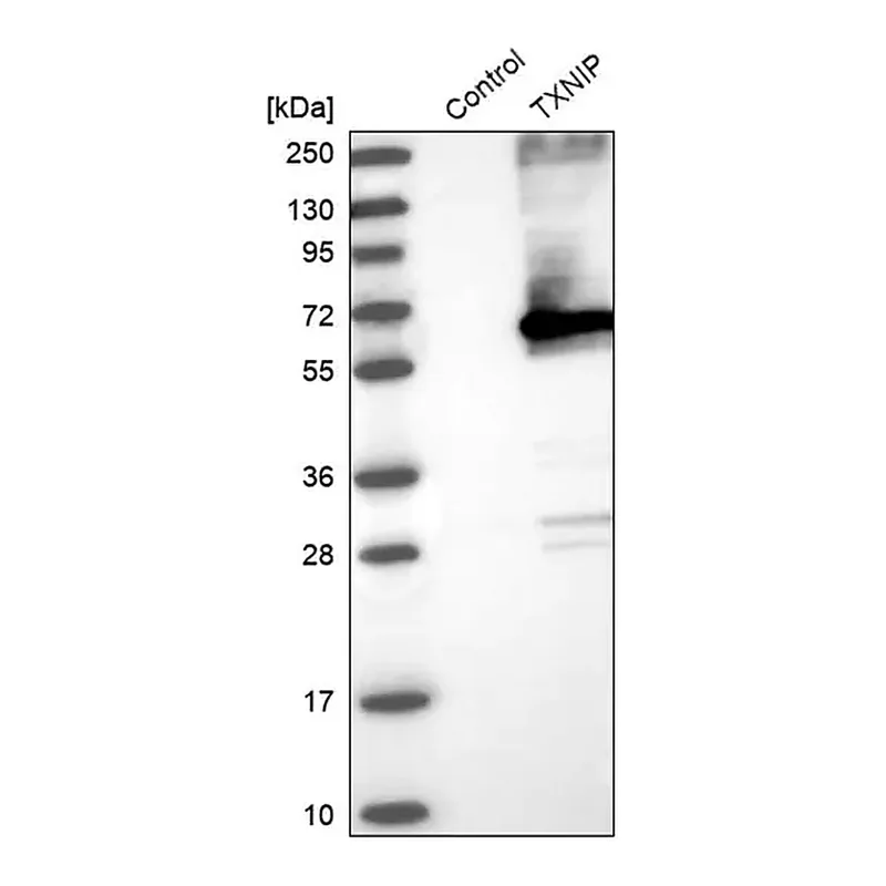 Merck Anti-TXNIP antibody produced in rabbit