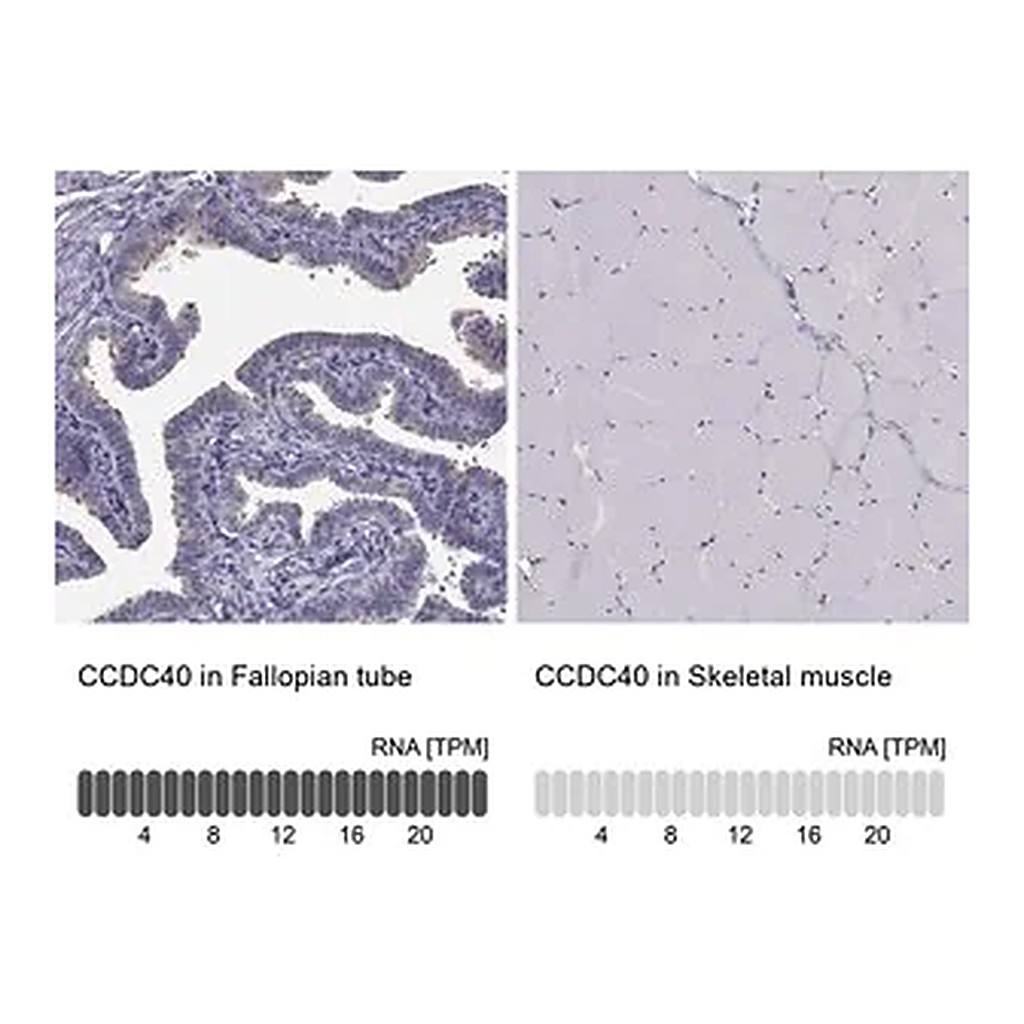 Merck Anti-CCDC40 antibody produced in rabbit