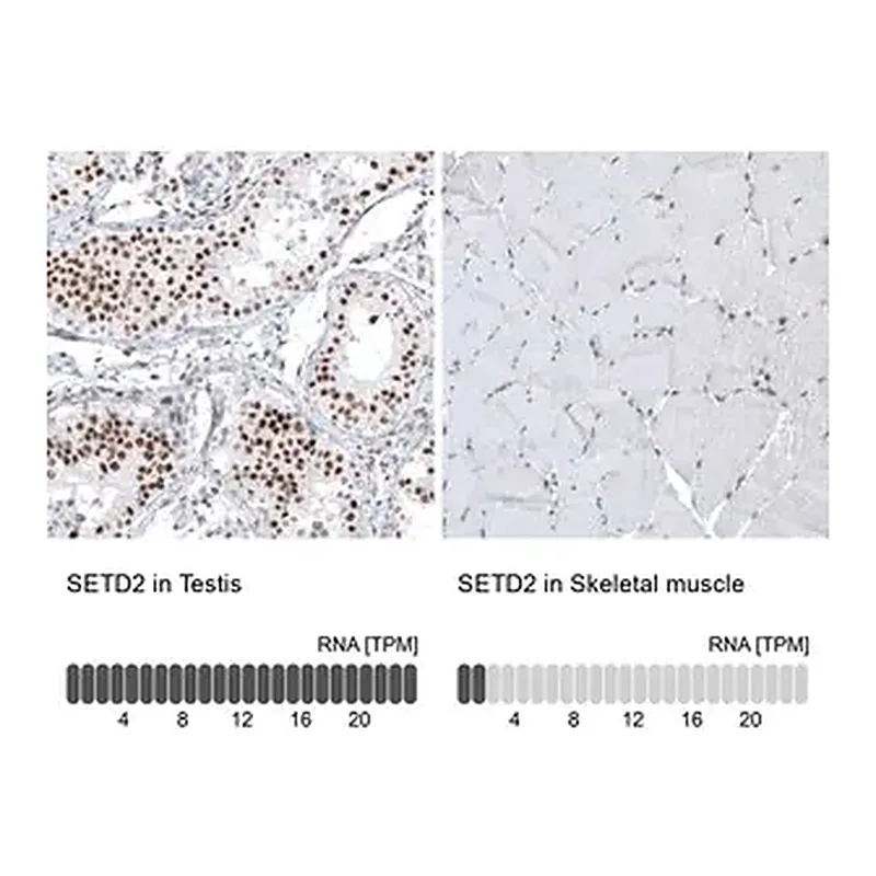 Merck Monoclonal Anti-SETD2 antibody produced in mouse