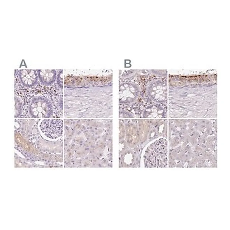 Merck Anti-HEXB antibody produced in rabbit