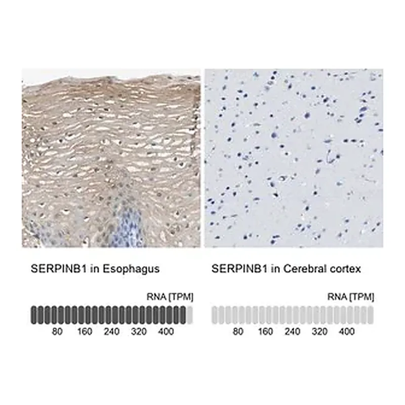 Merck Anti-SERPINB1 antibody produced in rabbit